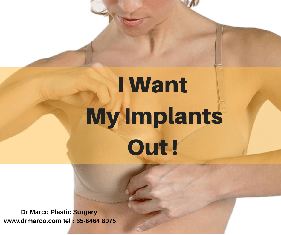 Why I Got My Implants Removed